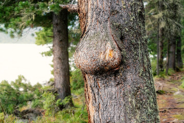 neoplasm or burl on the trunk of a pine tree in the forest. The concept of nature health and...