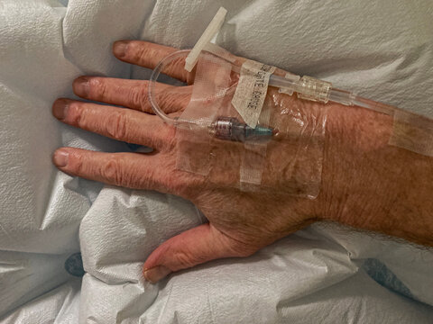A peripheral intravenous catheter in a male hand. Can deliver medicine, anesthetics, and is also used to draw blood samples.