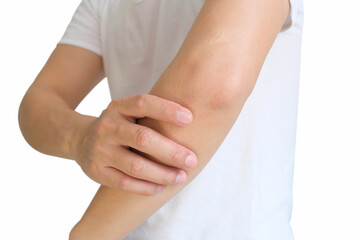 Men use their hands to hold their elbows and He had pain at the elbows. Painful Health and medical concepts