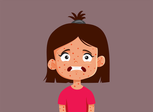 Little Girl Suffering from Measles Vector Cartoon Illustration