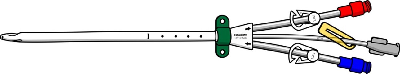 血液透析用トリプルルーメンカテーテルのイラスト