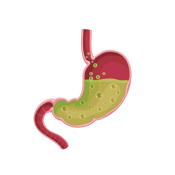 Stomach. Nausea. Diseases of the stomach. Vomiting Flat illustration