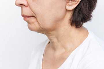 The lower part of the face and neck of an elderly woman with signs of skin aging isolated on a white background. Age-related changes, flabby sagging facial skin. Cosmetology and beauty concept - obrazy, fototapety, plakaty