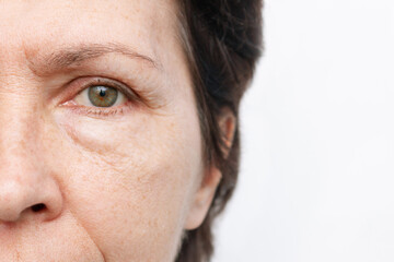 Cropped shot of an elderly caucasian woman's face with puffiness under her eyes and wrinkles...