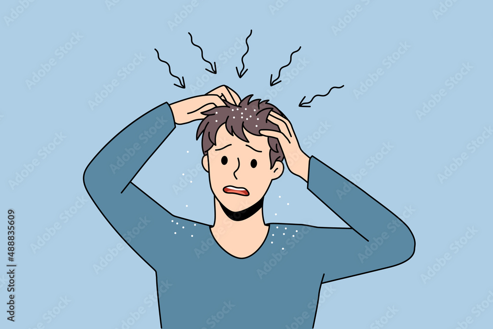 Wall mural itchy head and dandruff concept. stressed irritated man standing and having itchy scalp feeling prob