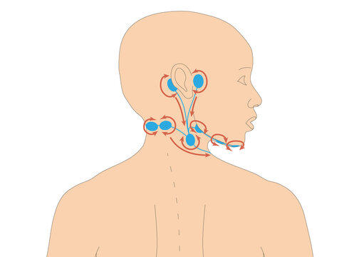 Infografik - Lymphdrainage am Menschen - Vorbehandlung am Hals