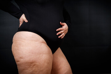 a fat woman with cellulite stands sideways on a black background