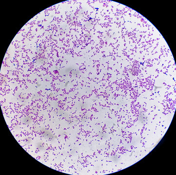 Escherichia coli bacterium, E.coli, gram-negative rod-shaped bacteria. 40x
