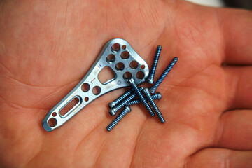 explanted surgical blue titanium radius plate lies in one hand