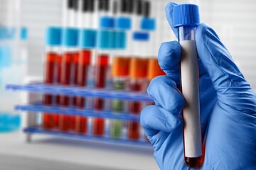 Omicron Variant on test tube, Covid 19 concept