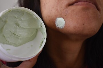 Indian Woman applied Neem face mask on acne