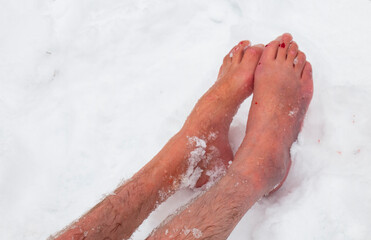 broken ankles in blood - deep scratches on the skin with bruises and wet marks in winter, accident