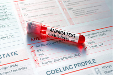 Blood sample for analysis of Anemia profile test in laboratory. Blood tube test with requisition...
