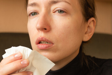 Portrait of young ill woman with runny nose sneezes into a napkin. Sick day at home. Illness cold...