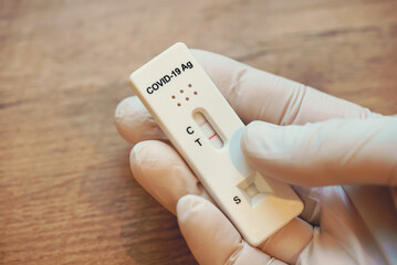 Virologist showing Positive Antigen Rapid Test for Coronavirus.