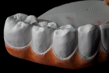 chewing area of a dental prosthesis from zircon of the upper jaw on a black background