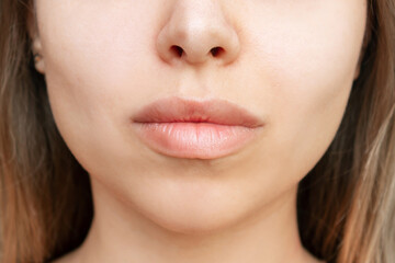 Obraz premium Cropped shot of young caucasian blonde woman's face with perfect lips after lip enhancement. Injection of filler in lips. Result of a lip augmentation. Close-up
