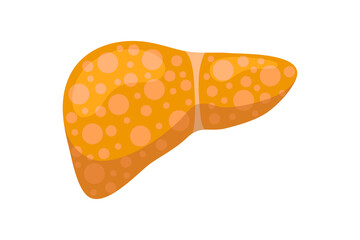 Sick unhealthy liver with jaundice or hepatitis. Human exocrine gland organ destruction concept. Vector hepatic eps illustration