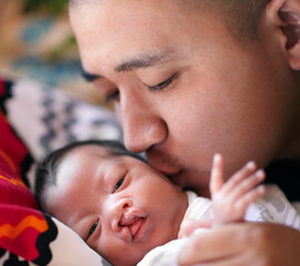 The loving kiss of a father. Shot of a young father giving his baby girl who has a cleft palate a...