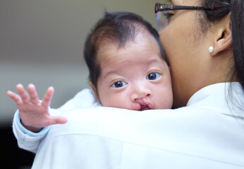 She is safe in her mothers arms. Portrait of a baby girl who has a cleft palate looking over the...