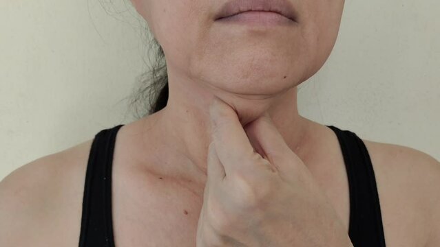 Portrait showing the fingers squeezing flabbiness cellulite under the neck, problem wrinkled sagging skin under the chin of the woman, concept health care.