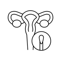 gynecological mirror tool line icon vector illustration