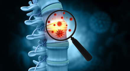 Spine cancer or spinal tumor disease