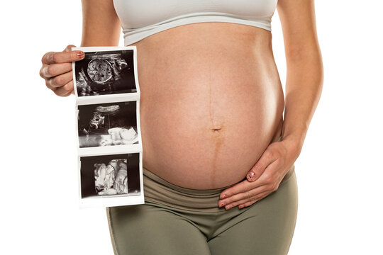 Pregnant woman with ultrasound scan pictures