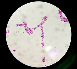 Blood agar bacterial colonies gram stained microscopic show Salmonella Typhi (S. Typhi) bacteria