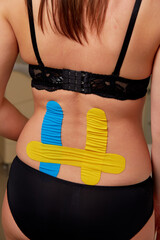 Kinesiology therapeutic taping of lumbar spine of young woman.