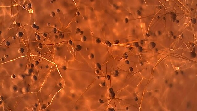 Microscope Mold on Pumpkin Spores x800 Biology Fungi