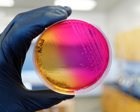 Salmonella growing on brilliant green sulfa agar producing a pink/red color.