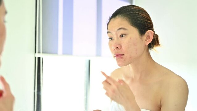 Asian woman applying acne cream on her face for treat and anti-inflammatory effect. Acne cream can helps to reduce the number of whiteheads and blackheads.