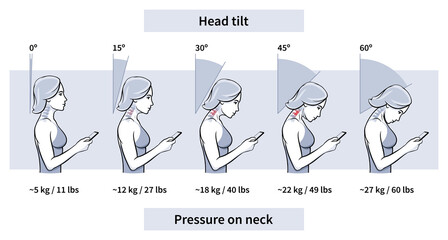 Load on neck and back when posture tilting head with phone, pain of weight, outline. Angle of bending head related to pressure on spine. Stage text neck syndrome. Vector illustration - obrazy, fototapety, plakaty