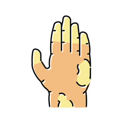 scleroderma skin disease color icon vector illustration