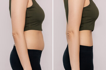 Two shots of a woman in profile with a belly with excess fat and toned slim stomach with abs before and after losing weight isolated on a beige background. Result of diet, liposuction, training - obrazy, fototapety, plakaty