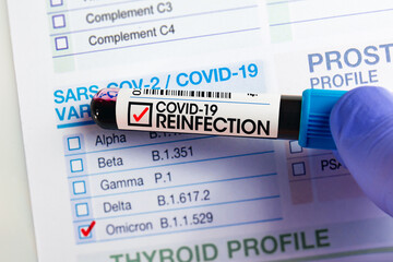 doctor holding blood tube over requisition form with reinfection positive to Covid-19 or coronavirus. patient blood sample tube reinfected with Sars-cov-2 or covid-19 and requisition form