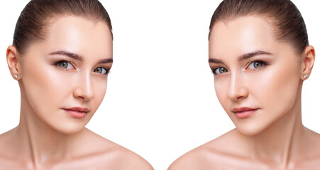 Young woman before and after chin correction. Over white background.