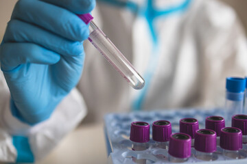 Fototapeta premium Process of coronavirus PCR antigen testing examination by nurse medic in laboratory lab, COVID-19 swab collection kit, test tube for taking OP NP patient specimen sample, patient receiving test