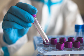 Process of coronavirus PCR antigen testing examination by nurse medic in laboratory lab, COVID-19...
