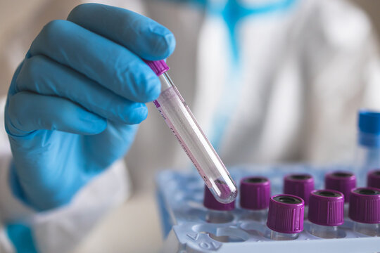 Process of coronavirus PCR antigen testing examination by nurse medic in laboratory lab, COVID-19 swab collection kit, test tube for taking OP NP patient specimen sample, patient receiving test