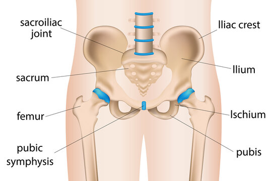  illustration of painful hip sacral inflammation, hip pain bursitis, arthritis