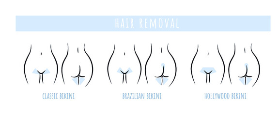 Hair removal bikini area line art. Brazilian, Hollywood, French bikini scheme. Vector - obrazy, fototapety, plakaty