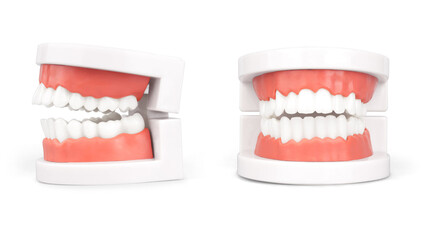 dental model isolated on white background