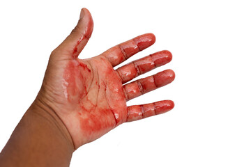Hand in blood on white background.