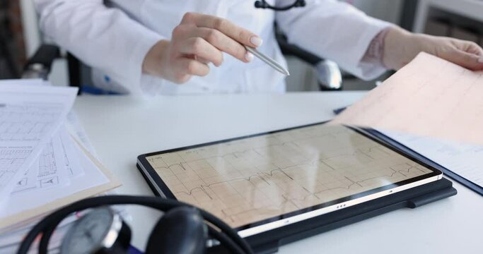 Cardiologist examines patient electrocardiogram on tablet closeup