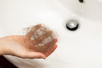 hand with loss hair
