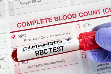 Blood tube test with requisition form for RBC Complete Red Blood Cells test. Blood sample tube for...