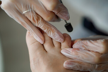 hands doing a pedicure on a man's leg with an apparatus