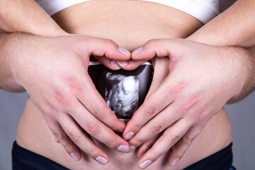 Ultraschallbild vom Baby mit zwei Händen gehalten auf Babybauch